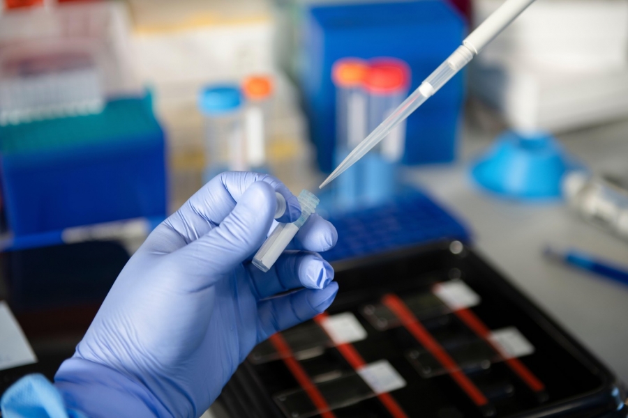 O nouă mașină moleculară descoperită prin AI: Claude identifică un sistem enzimatic similar cu CRISPR